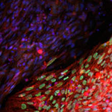 Induced pluripotent stem cells stained for the transcription factor Oct4 (Teisha Rowland).