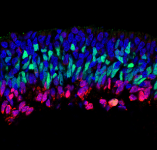 A section through a stem-cell derived retina from Mariya Moosajee’s team lights up under modern imaging techniques. Mariya Moosajee/UCL