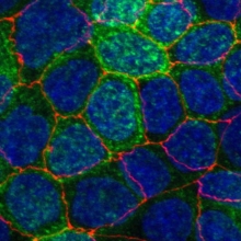 MDCK cells, X-Y