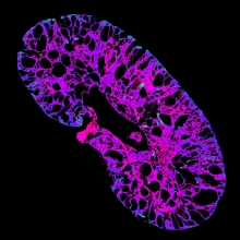 Mouse polycystic kidney stained for tubulin and DNA