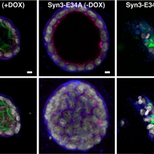 Effect of syntaxin 3 mis-targeting on MDCK cell cyst formation