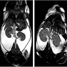 MRI scans: normal mouse vs. polycystic kidney mouse