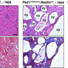 Histology of efficacy of rapamycin treatment on mouse polycystic kidney disease